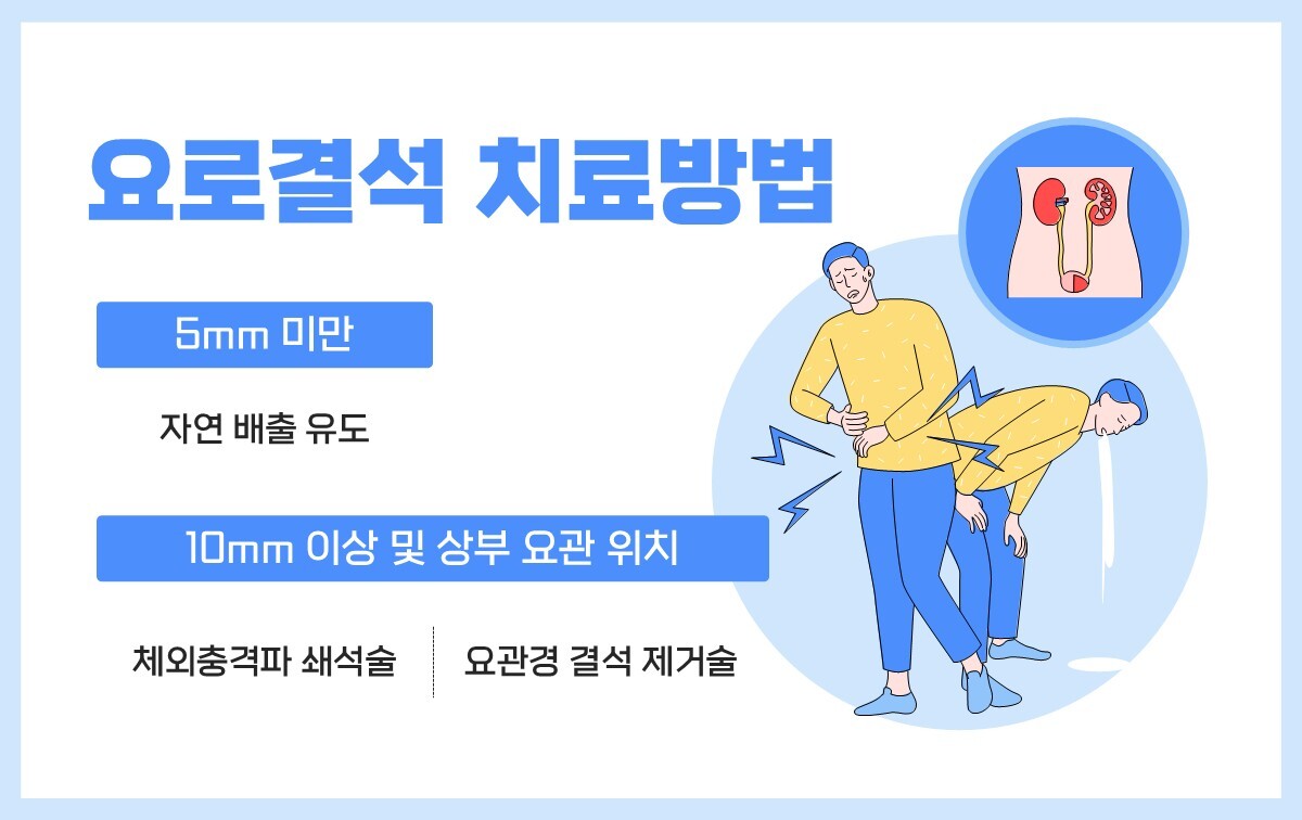 소변 지나가는 길에 돌… 극심 통증 요로결석 주의 [건강+]
