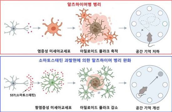 FDA 승인 약물을 치매 치료제로 활용…DGIST "폭주 뇌 면역세포 잠재웠다"[과학을읽다]