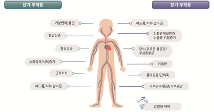 중증천식 환자 대상 '한국인 맞춤형' 스테로이드 사용 기준안 나왔다