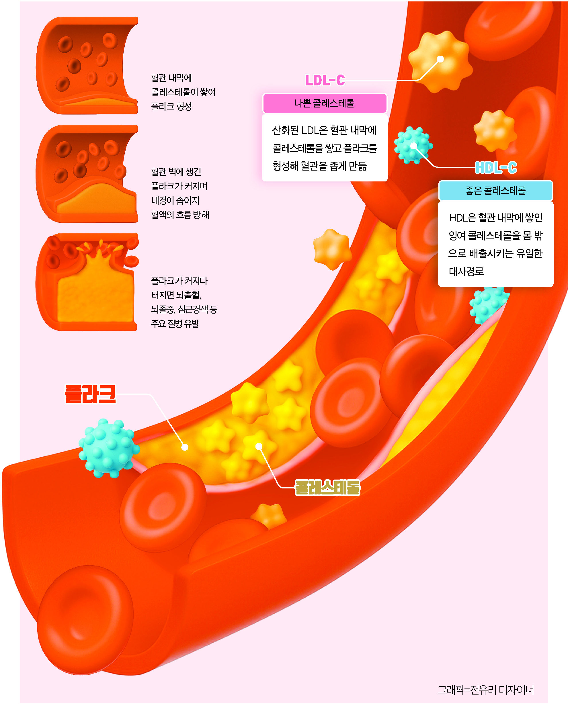 [Health&] 혈관 디톡스의 열쇠 HDL 높여야 심뇌혈관 튼튼