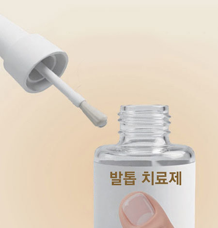 발톱무좀, SNS를 점령한 ‘가짜 완치’의 유혹[이진한의 메디컬리포트]